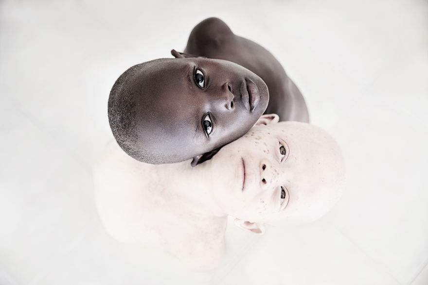 Черное и белое: фотограф из Голландии показала красоту альбиносов Танзании.Вокруг Света. Украина