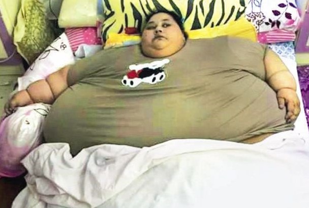 В больнице Абу-Даби умерла самая тяжелая женщина в мире.Вокруг Света. Украина