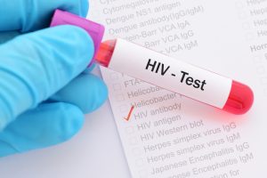 Новое открытие защитит женщин от ВИЧ