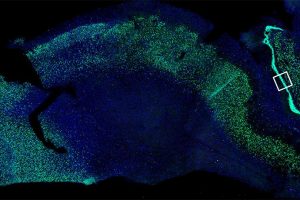 Ученые выявили признаки нейрогенеза в мозге взрослого