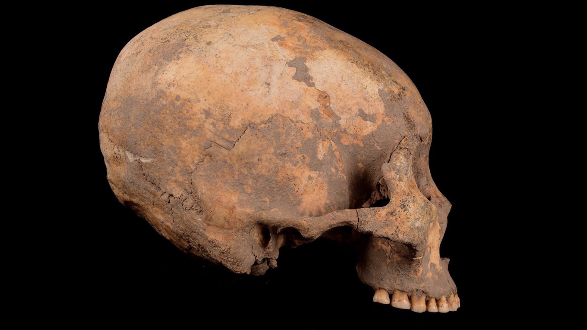 В Китае нашли древнейшее свидетельство искусственной деформации черепа.Вокруг Света. Украина