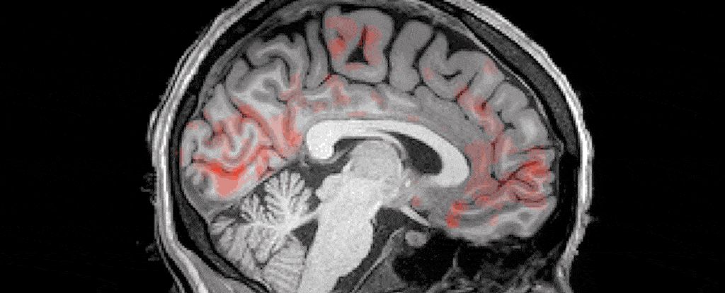 Нейробиологи показали, как спинномозговая жидкость циркулирует в мозге.Вокруг Света. Украина