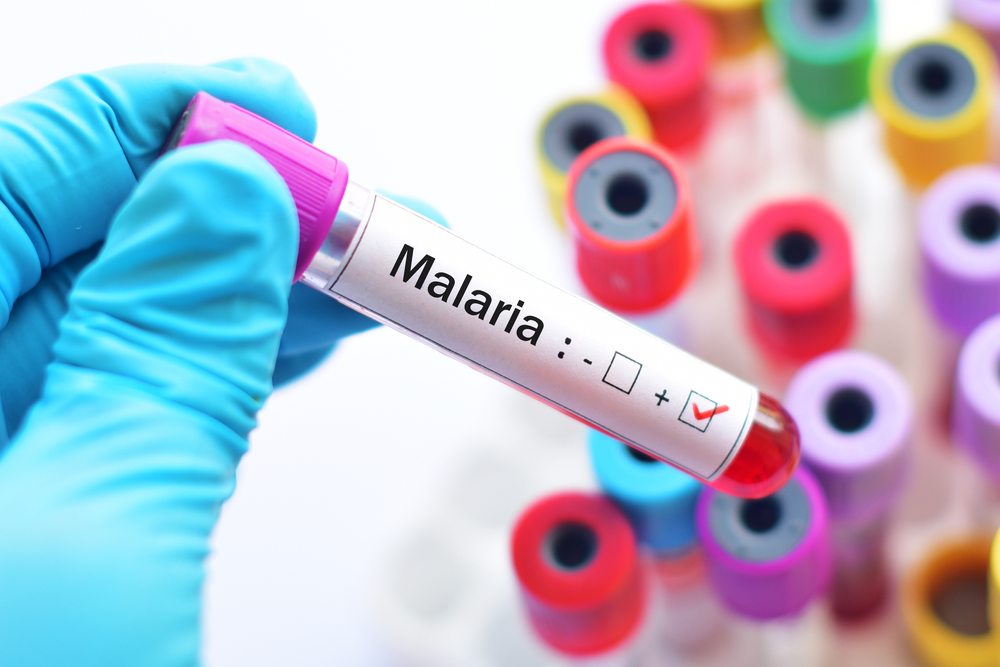 Малярия в Киеве: из каких стран привозят смертельную инфекцию.Вокруг Света. Украина