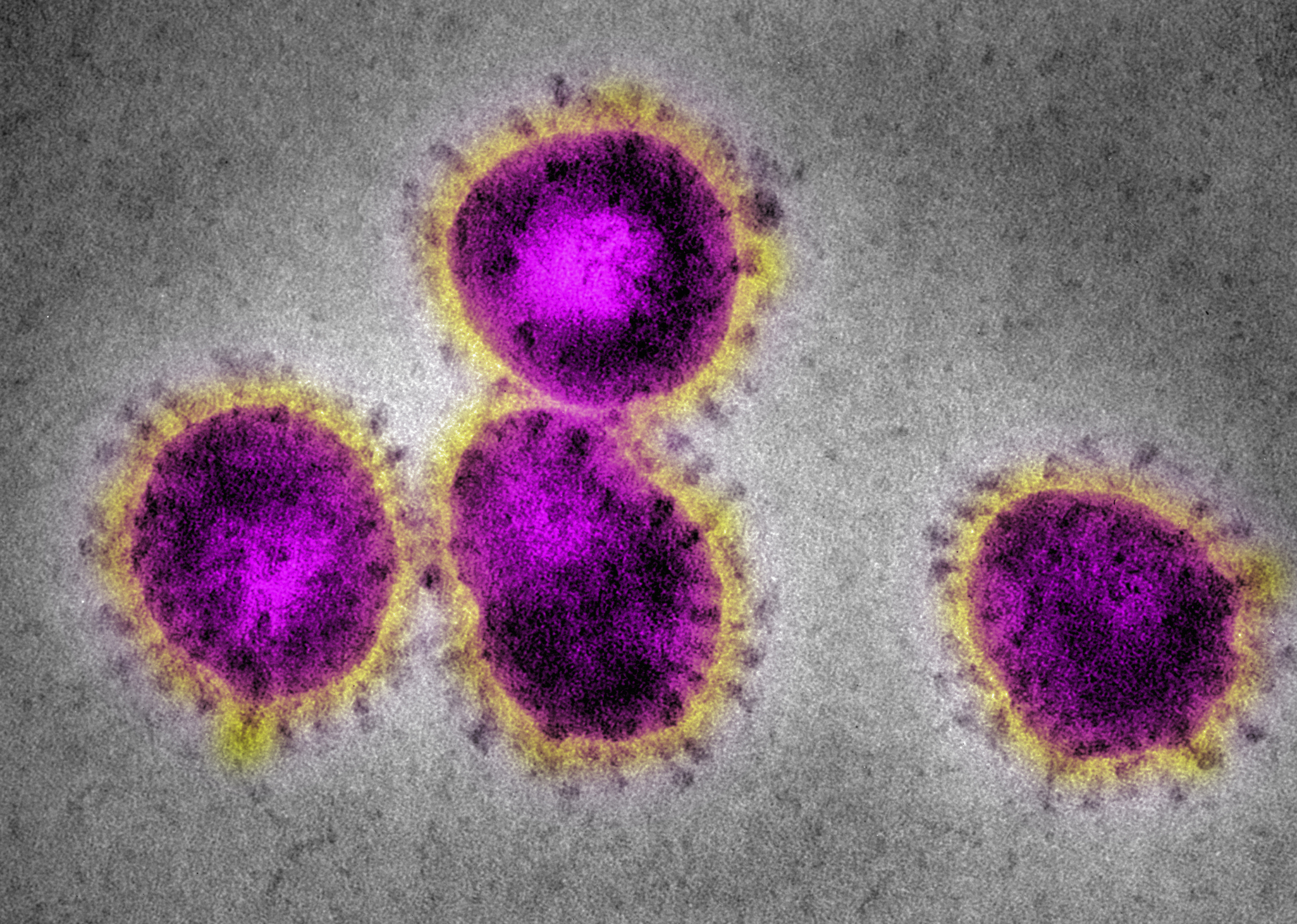 В Украине зафиксировали три подозрения на китайский коронавирус