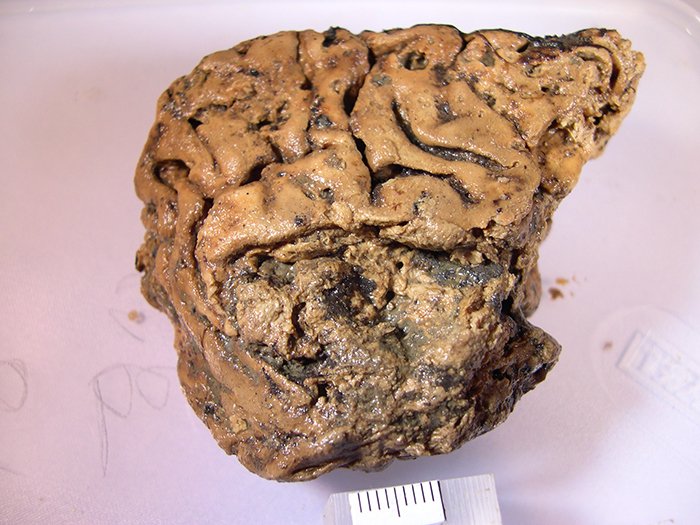 Ученые выяснили секрет сохранности 2600-летнего мозга из Хеслингтона.Вокруг Света. Украина