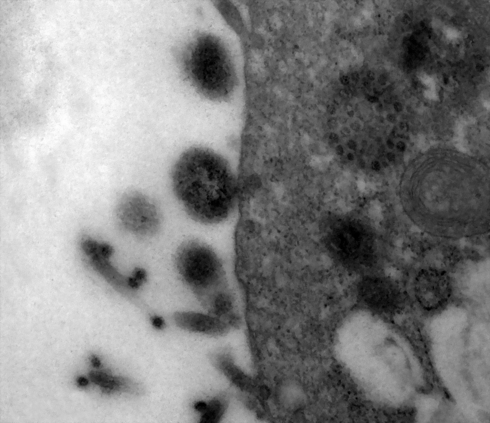 Ученые запечатлели момент, когда коронавирус заражает здоровую клетку.Вокруг Света. Украина