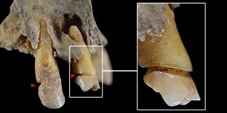 Анализ зубов рассказал о профессии древних жительниц Испании.Вокруг Света. Украина