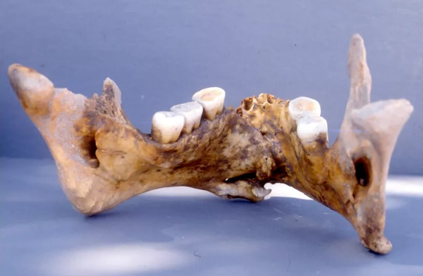 Археологи нашли останки византийского воина с «золотой» челюстью.Вокруг Света. Украина