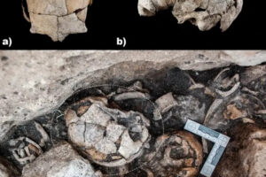 Хирургия времен Неолита: археологи нашли череп со следами операции, которому больше 5 тысяч лет